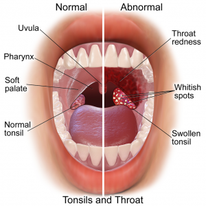 throat symptoms