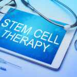 Stem Cell Therapy 101: What Is It and How Does It Work?