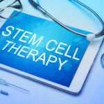 5 Benefits of Stem Cell Therapy
