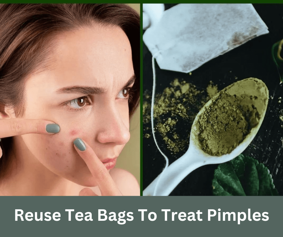 fight pimple and acne with used tea bags